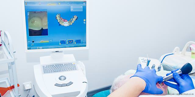 Cerec Cerec
